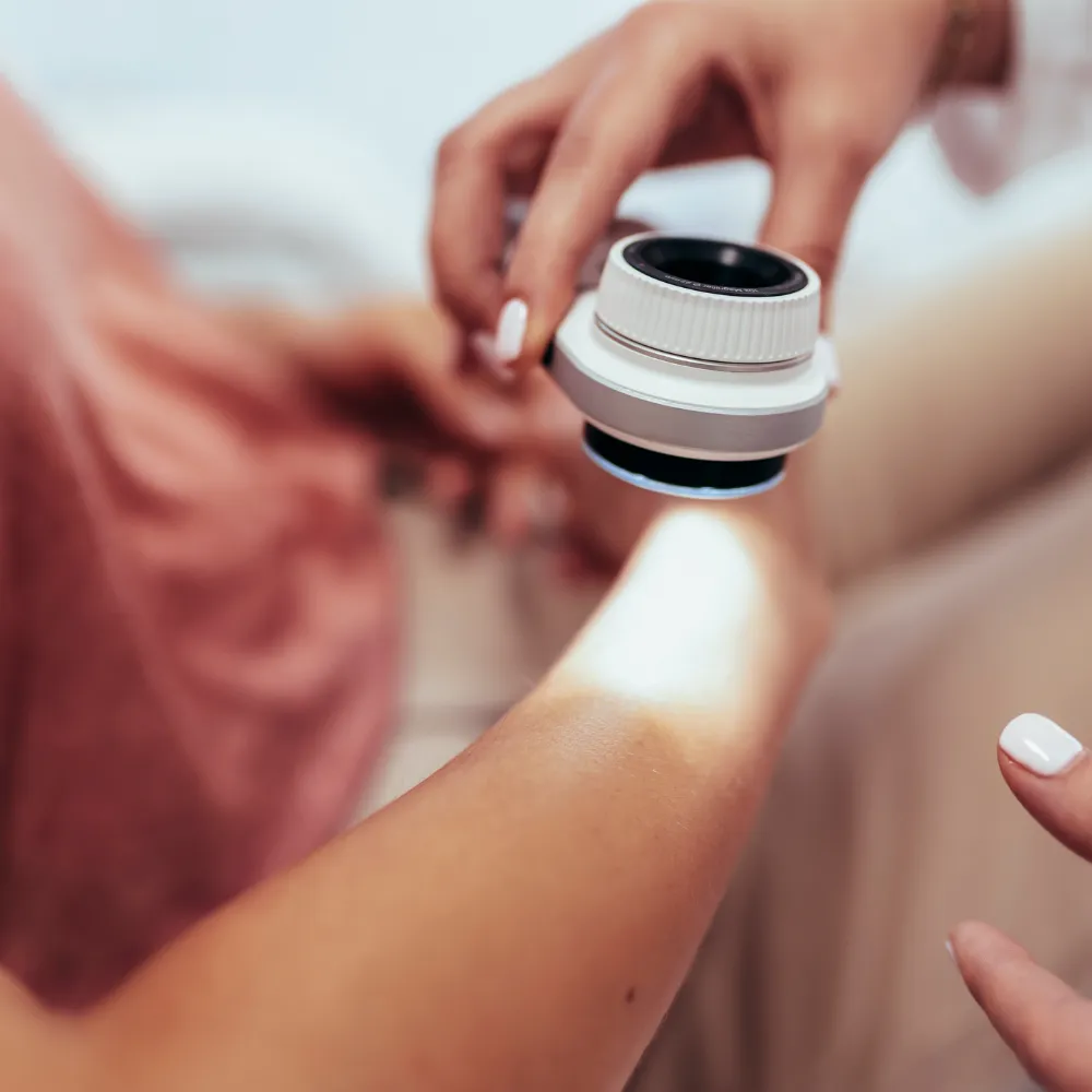 30% Off Mole Screening